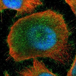 Kaiso Antibody, Novus Biologicals 0.1mL; Unlabeled:Antibodies, Polyclonal